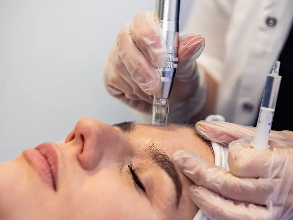Anti-âge Microneedling La clinica